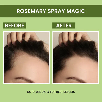 Rosemary Water, Hair Spray For Regrowth [Buy 1 Get 1 Free]